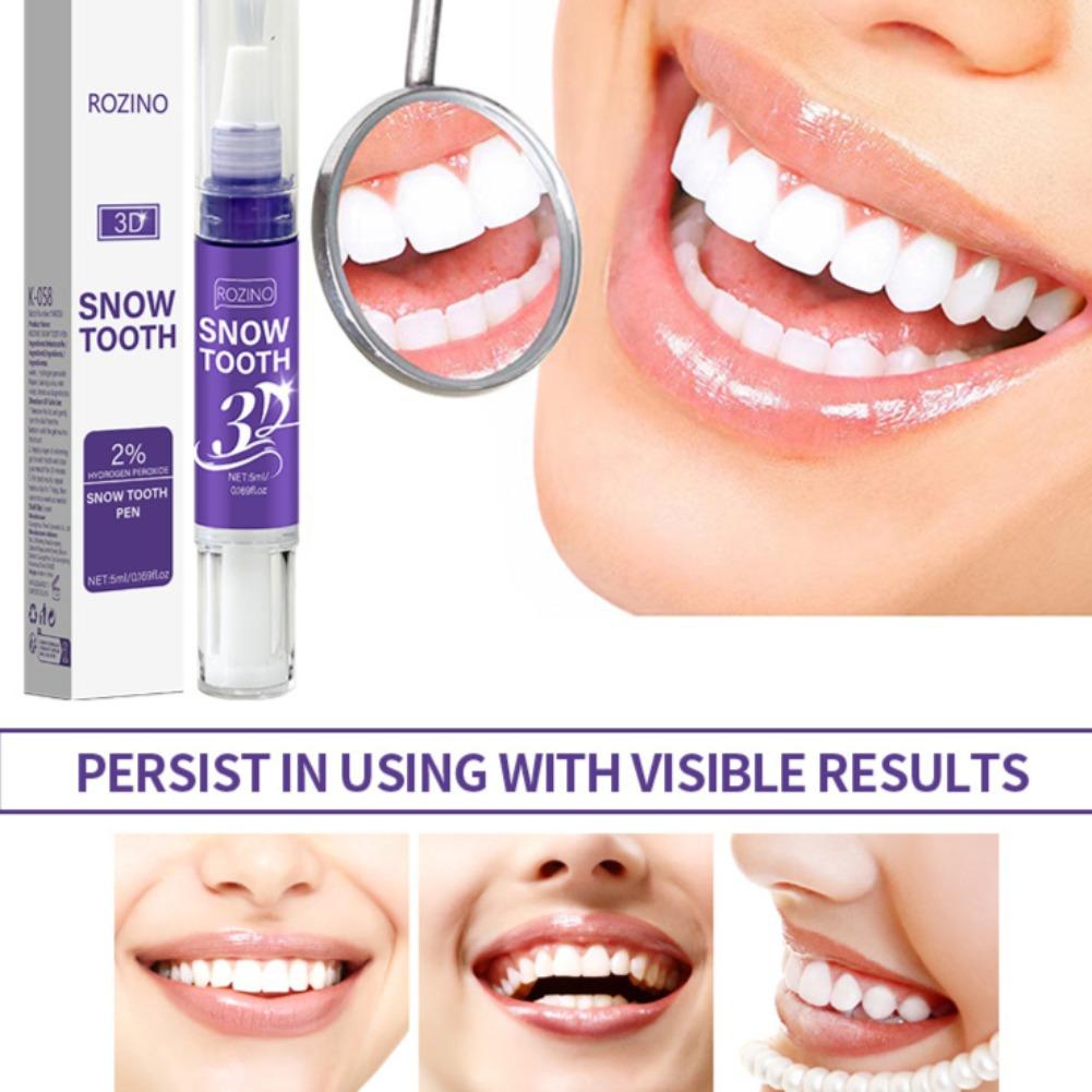 3D-ручка для отбеливания зубов – обзор и цена Teeth Whitening Pens